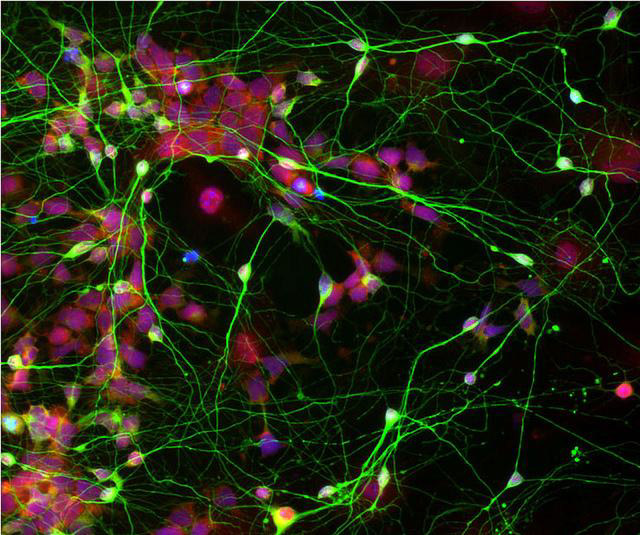 stem cells (pink) in the process of reprogramming to neurons (green)