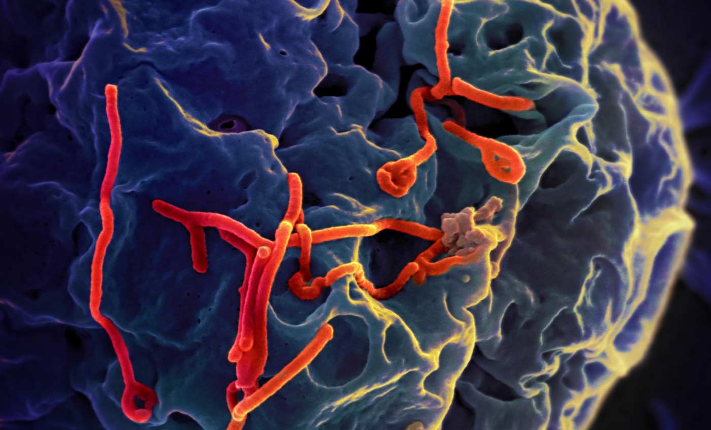 Ebola virus particles budding from a cell