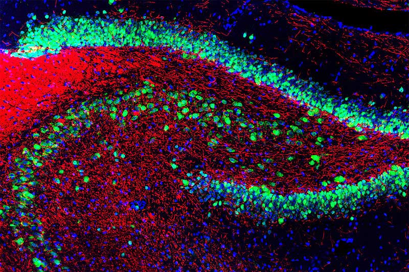 Slice of rodent hippocampus (fluorescently stained), the area of the brain first affected by Alzheimer's