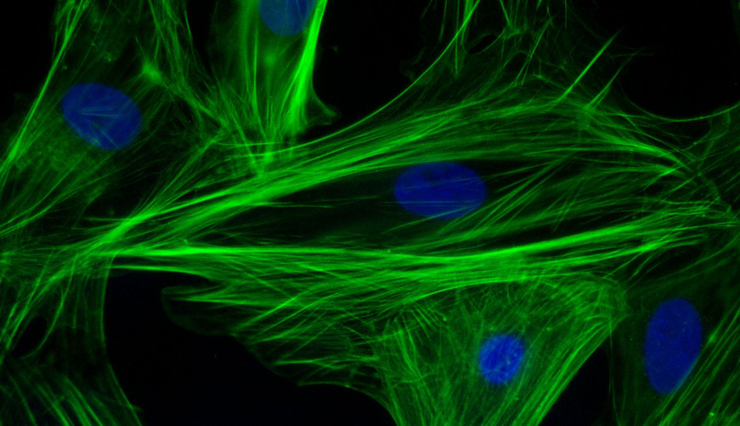 Heart muscle cells (actin filaments in green, nuclei in blue)