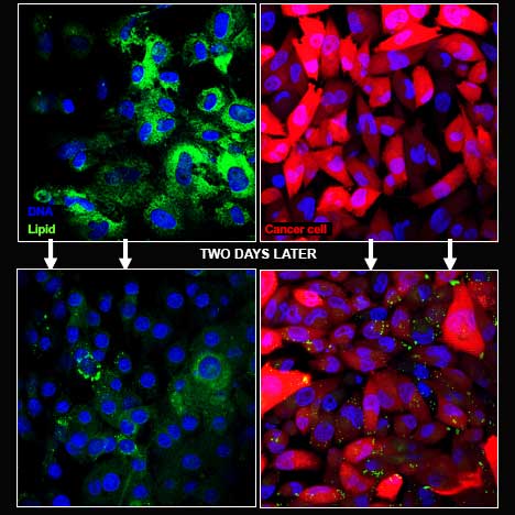 Flourescent cancer cells