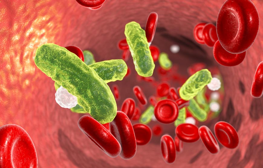 Sepsis bacteria in blood