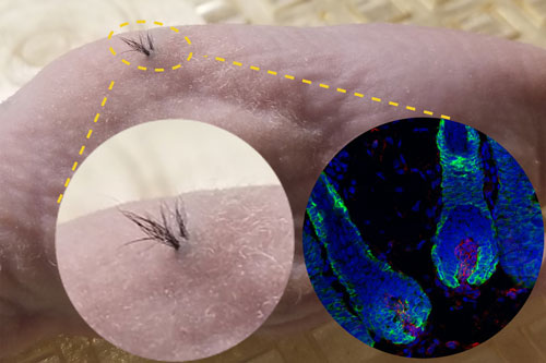 Hair growth in nude mice transplanted with human iPSC-derived dermal papilla cells that were combined with mouse epithelial cells inside a biodegradable scaffold. Left insert: enlarged outside view. Right insert: fluorescent microscopy image of hair follicles under the skin; cell nuclei (blue), epithelial cells (green), human dermal papilla cells (red).