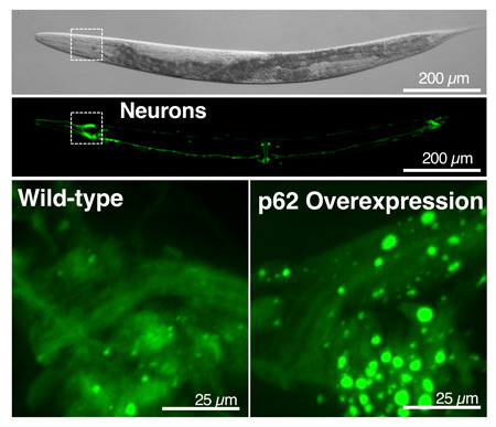 Surprisingly large “recycling plants,” or vesicles (bright green circles shown in the lower right image), appeared in worms that produce excess levels of the p62 protein, akin to a “cellular recycling truck.” These worms lived a week longer than worms with normal levels of p62 equivalent to a 20 to 30% lifespan extension.