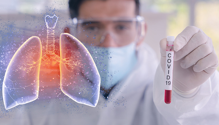 lungs and covid-19 photo illustration