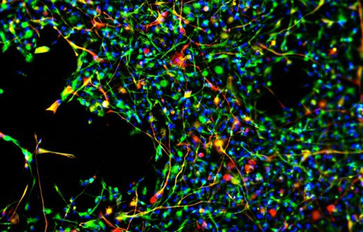 maturing neural stem cells, neural stem cells maturing into astrocytes (yellow).