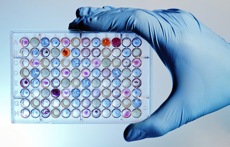 hand with a microplate filled with color samples