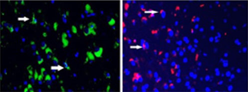 mice cells neurodegenerative condition