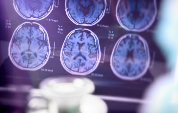 photo brain scans