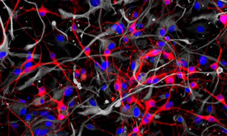 Neural networks grown from human stem cells