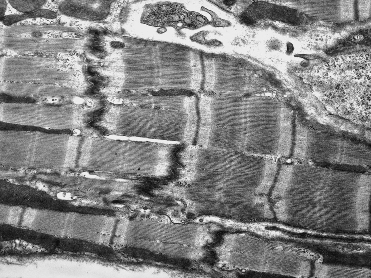 a transmission electron micrograph of bundled and banded cardiac muscle. Image courtesy of the Wellcome Collection