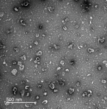 Negative-stain transmission electron microscopy was used to confirm the isolation of small extracellular vesicles in mouse neurons, as well as in mouse astrocytes and microglia