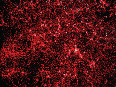 Immunofluorescence was used to validate primary cell culture purity