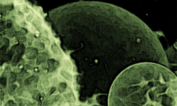 portrait of extracellular vesicles taken using confocal laser scanning microscopy