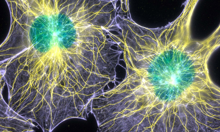 fluorescent micrograph of filamentous actin and microtubules in mouse fibroblasts