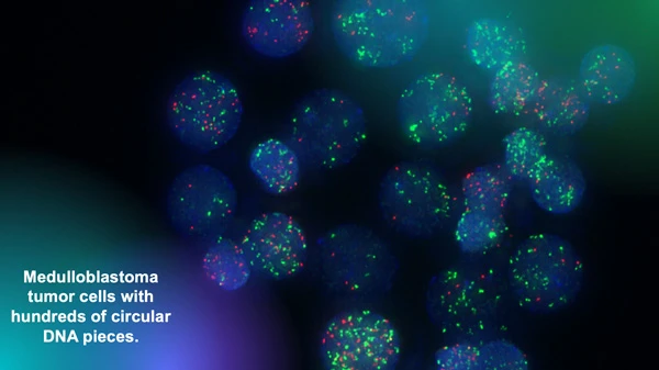 Medulloblastoma tumor cells with hundreds of circular DNA pieces