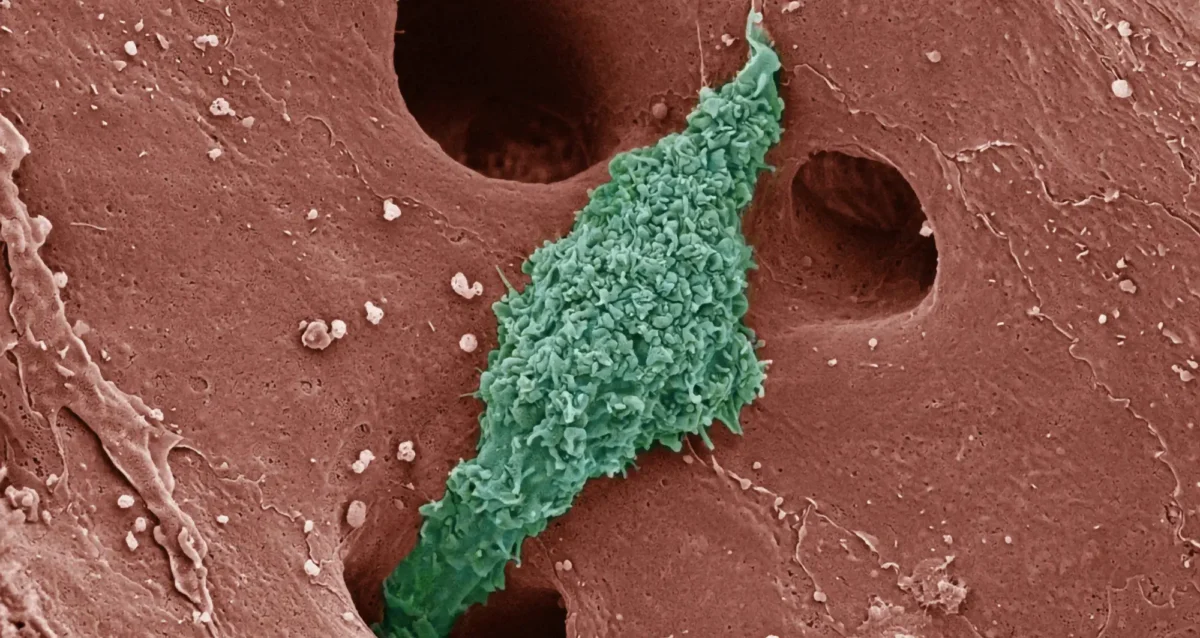 colorized scanning electron micrograph depicting a Kupffer cell