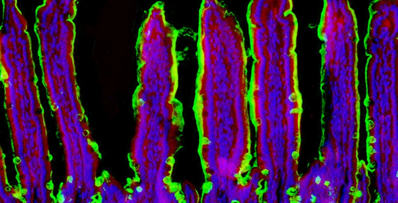 colitis image from Marth lab