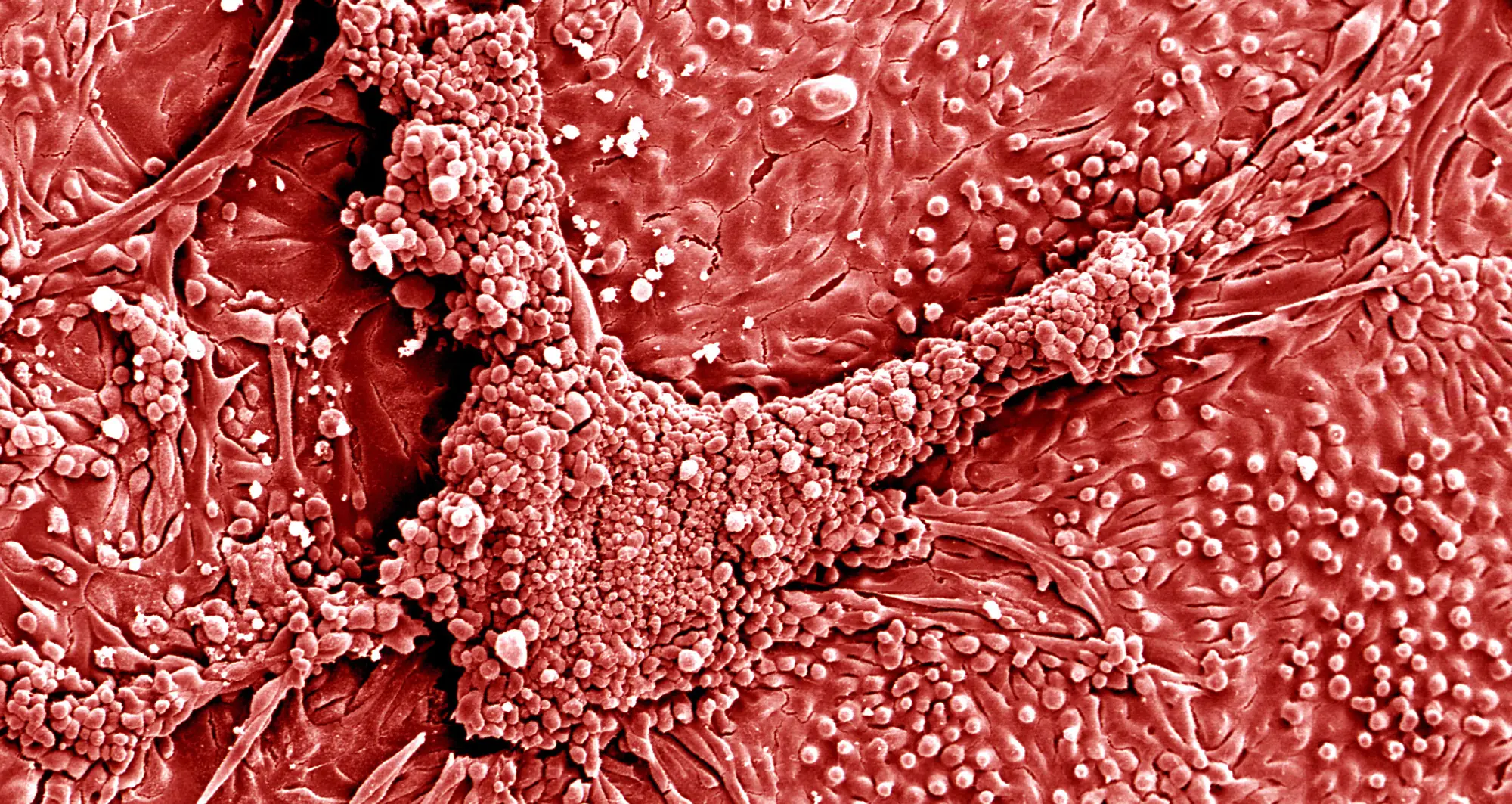 colorized scanning electron micrograph of a human proximal tubule