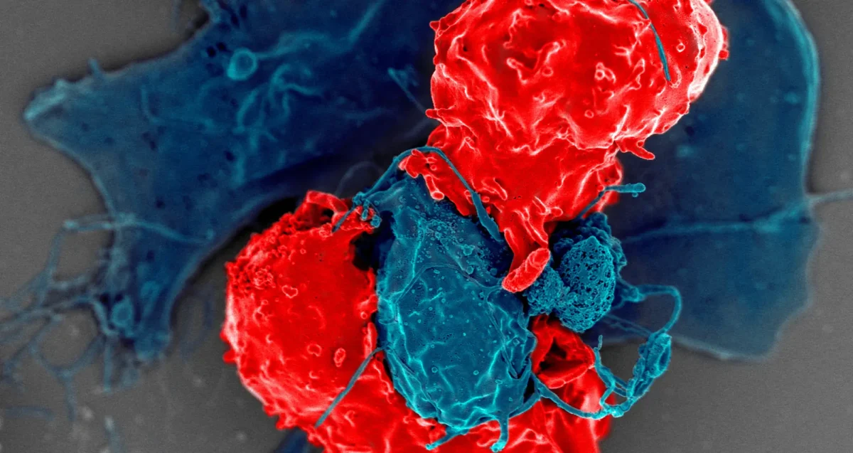 A colorized scanning electron micrograph depicts T regulatory cells (red) interacting with antigen-presenting cells (blue)