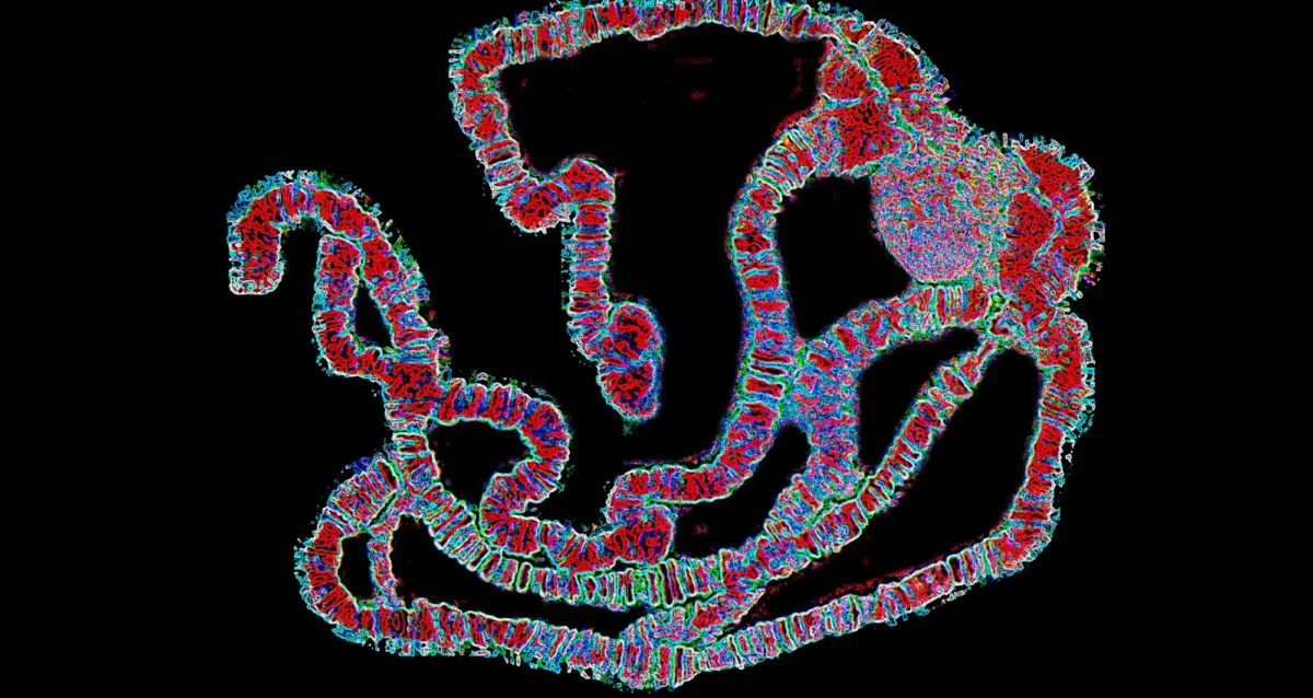 A chromosome from Drosophila melanogaster (fruit fly) salivary glands, using Brightfield microscopy