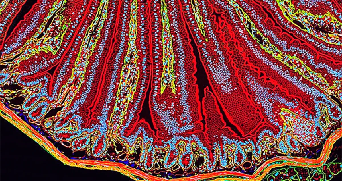 A quantum dot fluorescence image depicts a section of mouse small intestine