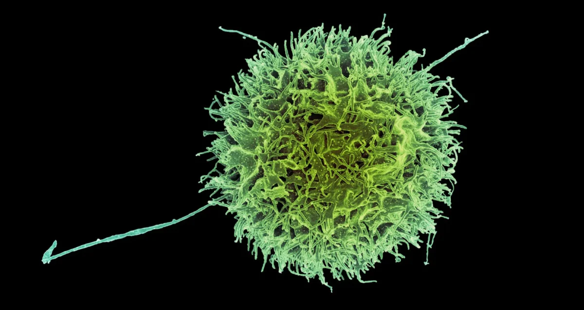 colorized scanning electron micrograph of a natural killer cell from a human donor