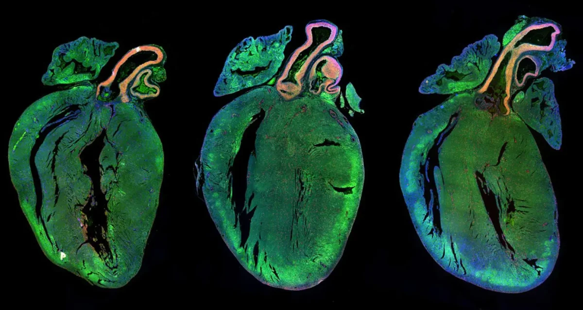 Sections of a rat heart shown using fluorescence microscopy imaging