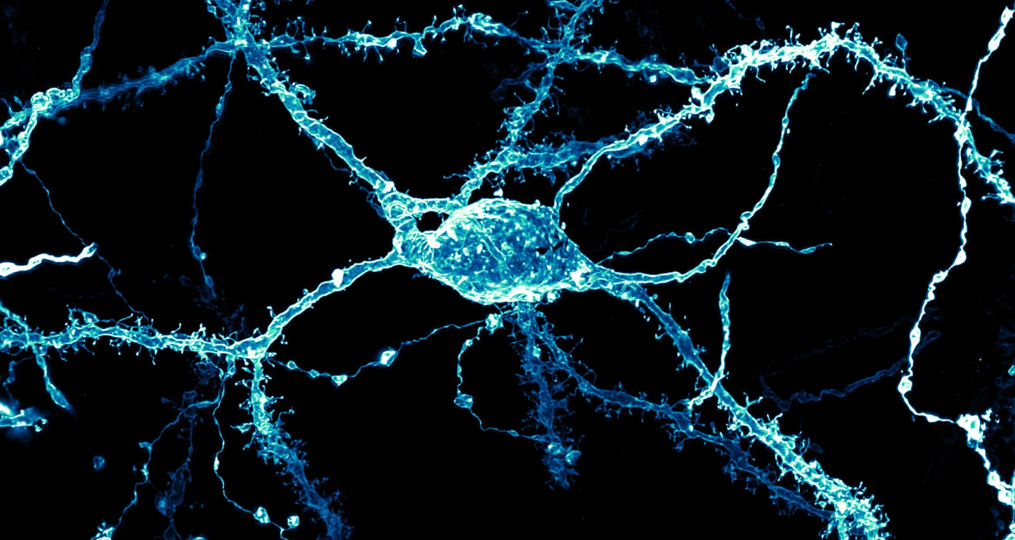 A neuron covered in dendritic spines from the striatum of an adult rat brain