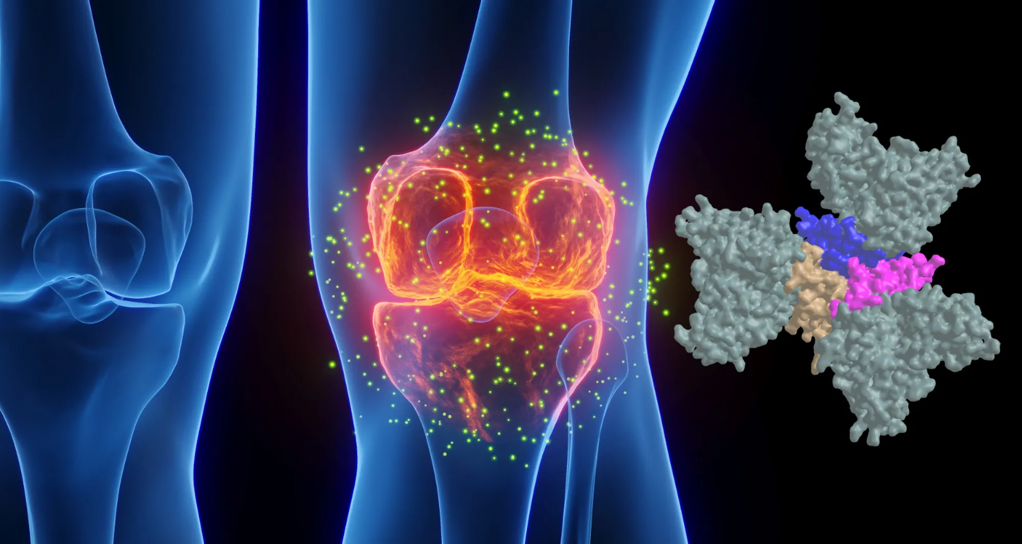 Tumor necrosis factor-α (TNF), shown in pink and tan, is depicted in a complex with an antibody called golimumab, pictured in slate gray