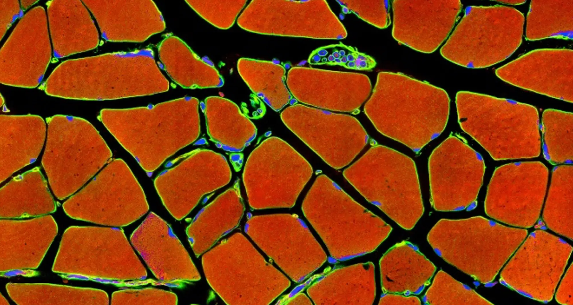 muscle cells