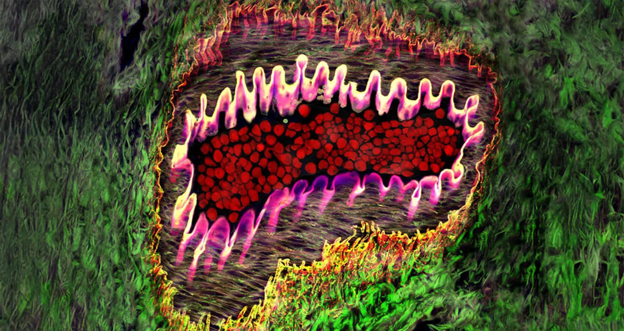 Healthy arteriole in eye, with tough, flexible elastin wall (pink), red blood cells (red) and supporting collagen fibers (web-like netting) surrounded by yellow and green areas