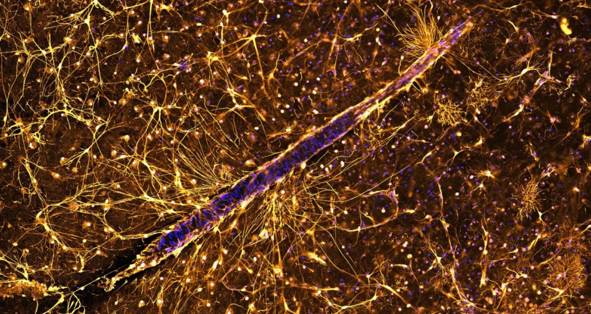 Astrocytes surrounding a blood vessel in a thin slice of human brain