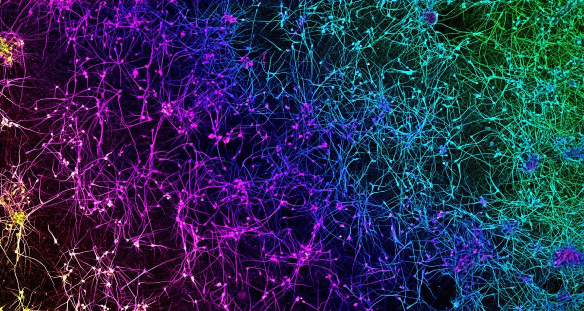 A network of dopaminergic neurons generated from human stem cells