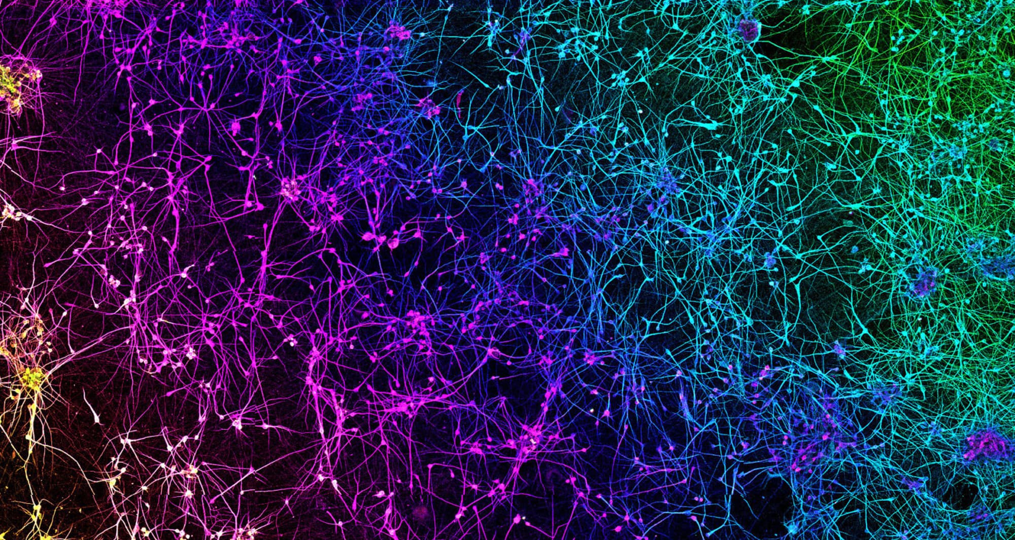 A network of dopaminergic neurons generated from human stem cells