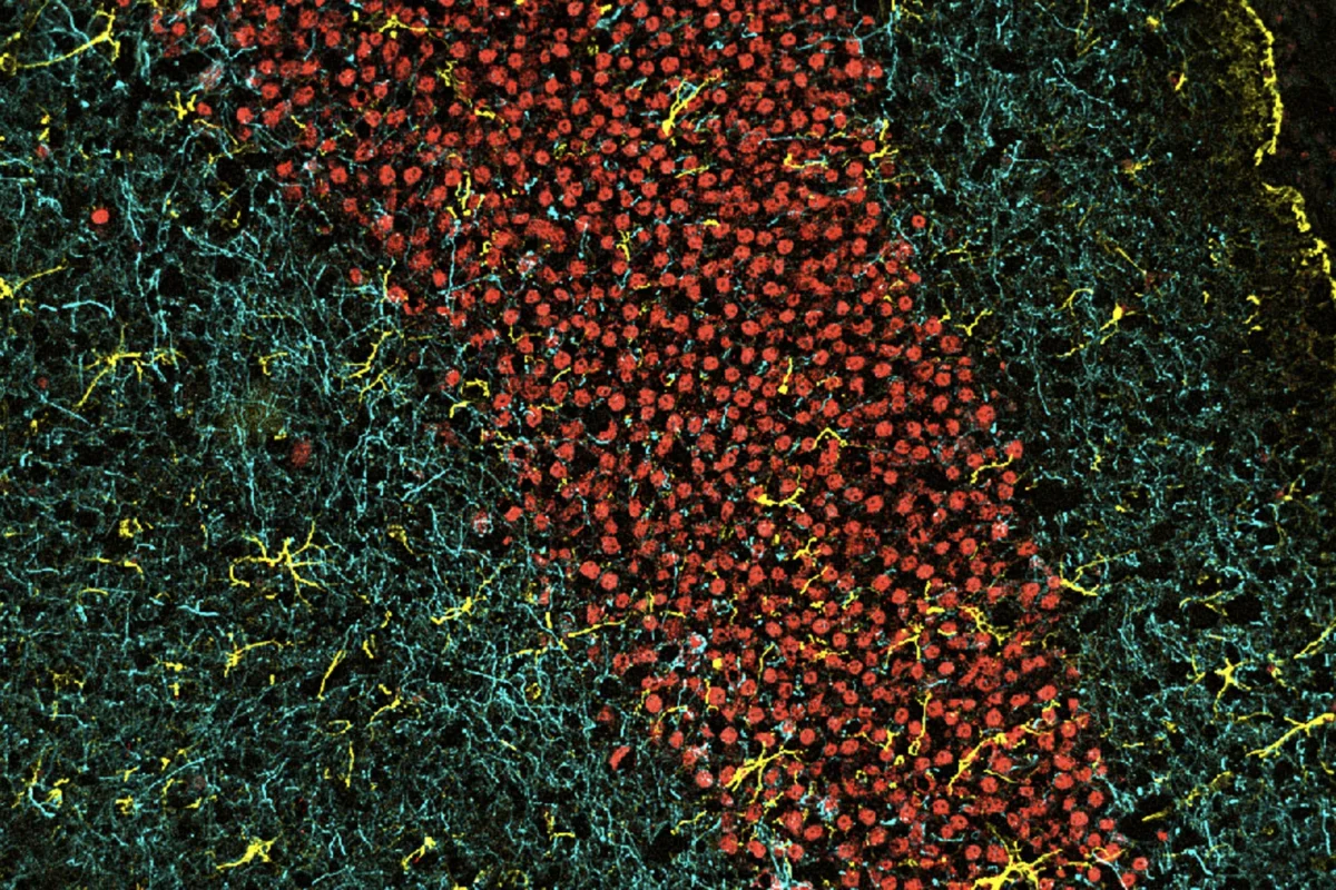 The brain is composed of billions of connections. Pictured are a group of neurons (their nuclei in red), the complexity of axon projections (labeled in cyan), and supportive astrocytes (labeled in yellow) from the hippocampus region of a murine brain. Image courtesy of Sara Ancel, Annanya Sethiya and Will Wang’s lab.