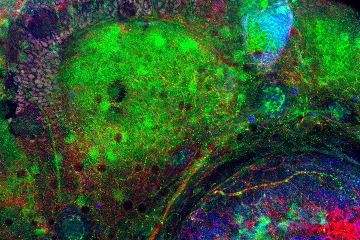 The brain sections of zebrafish embryos help scientists at Sanford Burnham Prebys study disorders that cause the brain to deteriorate over time. Image courtesy of Keith Gates and Duc Dong’s lab.