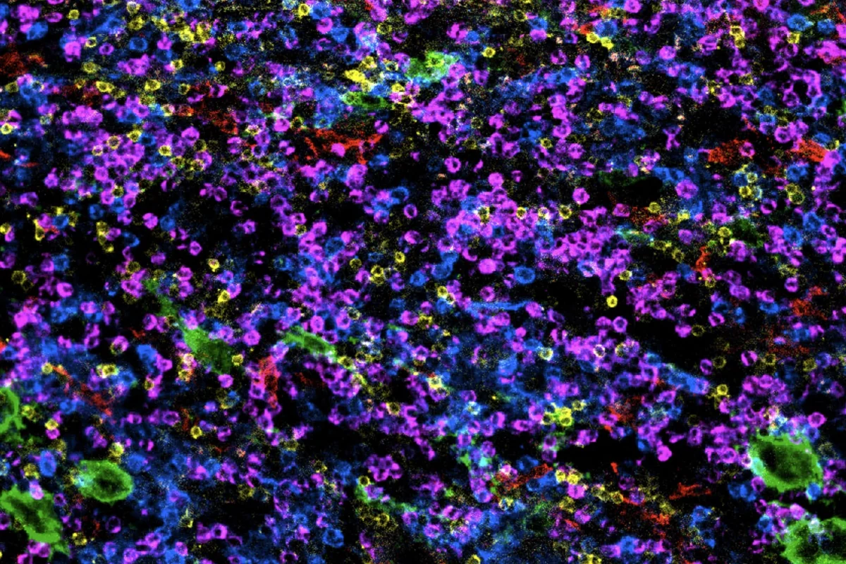 Immune cells are defenders of our bodies. This micrograph shows the diversity of immune cells in the bone marrow, where they are born and mature. Each color represents a specialized immune cell type, captured by state-of-the-art highly multiplexed microscopy and methods developed at Sanford Burnham Prebys. Image courtesy of Beatrice Silvestri and Will Wang’s lab.