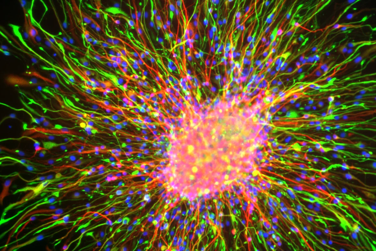 A view of the differentiation of neural rosette cells into more mature cell types. Neural rosette cells can become any type of neural cell: neurons, oligodendrocytes and astrocytes. The cell nuclei are labeled in blue. Image courtesy of Brandon Nelson.