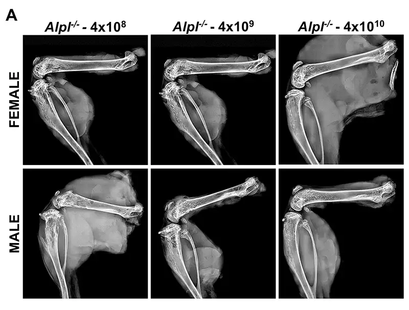 José Luis Millán supplemental figure - results from radiographic analysis of long bones in mice treated with gene therapy for early onset hypophosphatasia