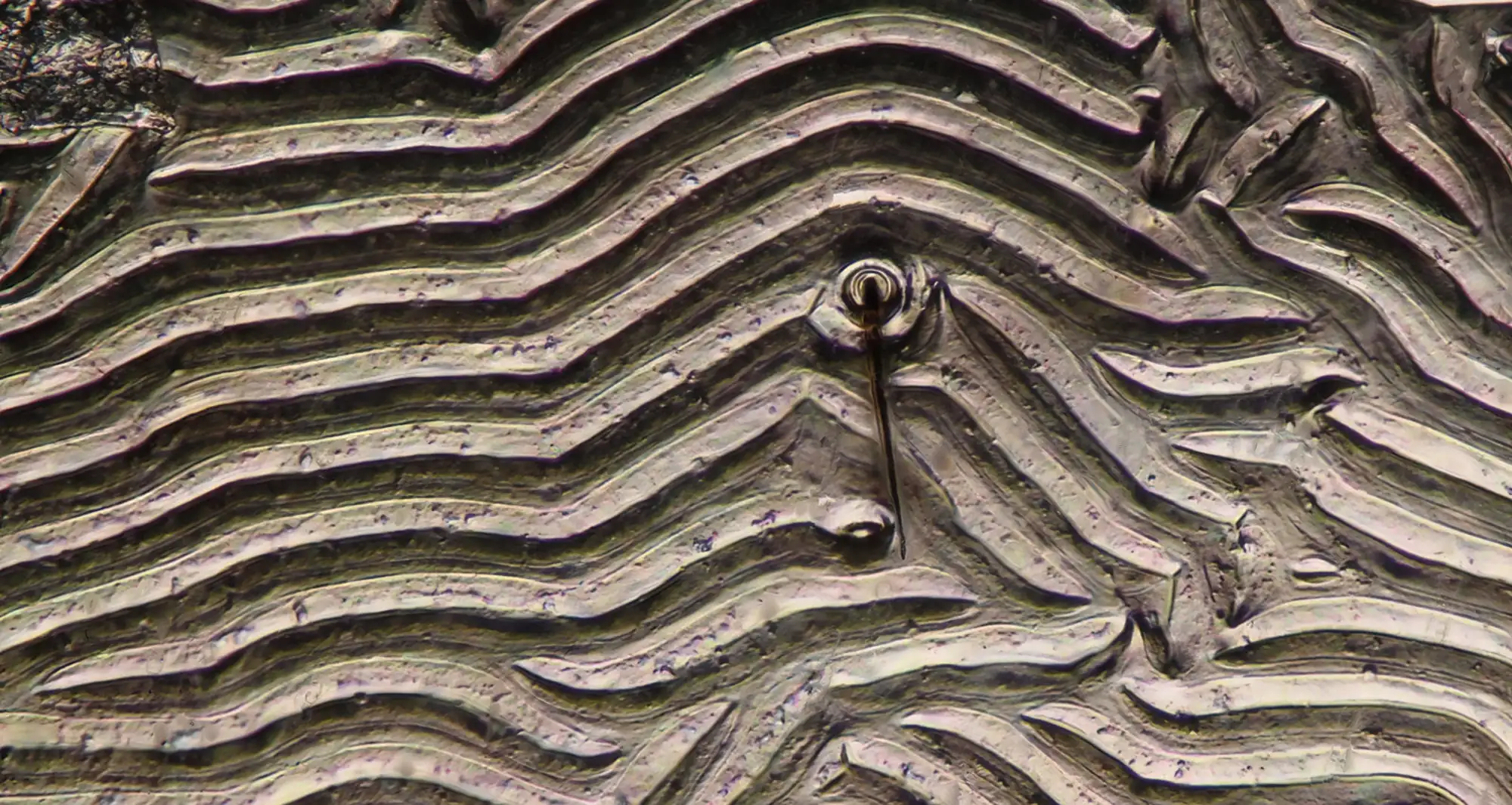 abdominal skin of a tick engorged with blood