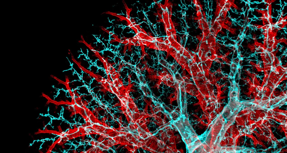 confocal micrograph of a mouse lung