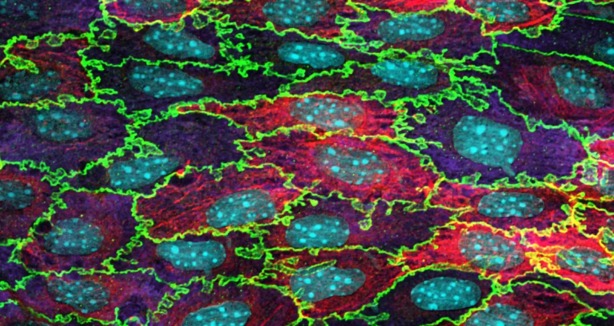 Confocal micrograph of mouse aortic endothelium