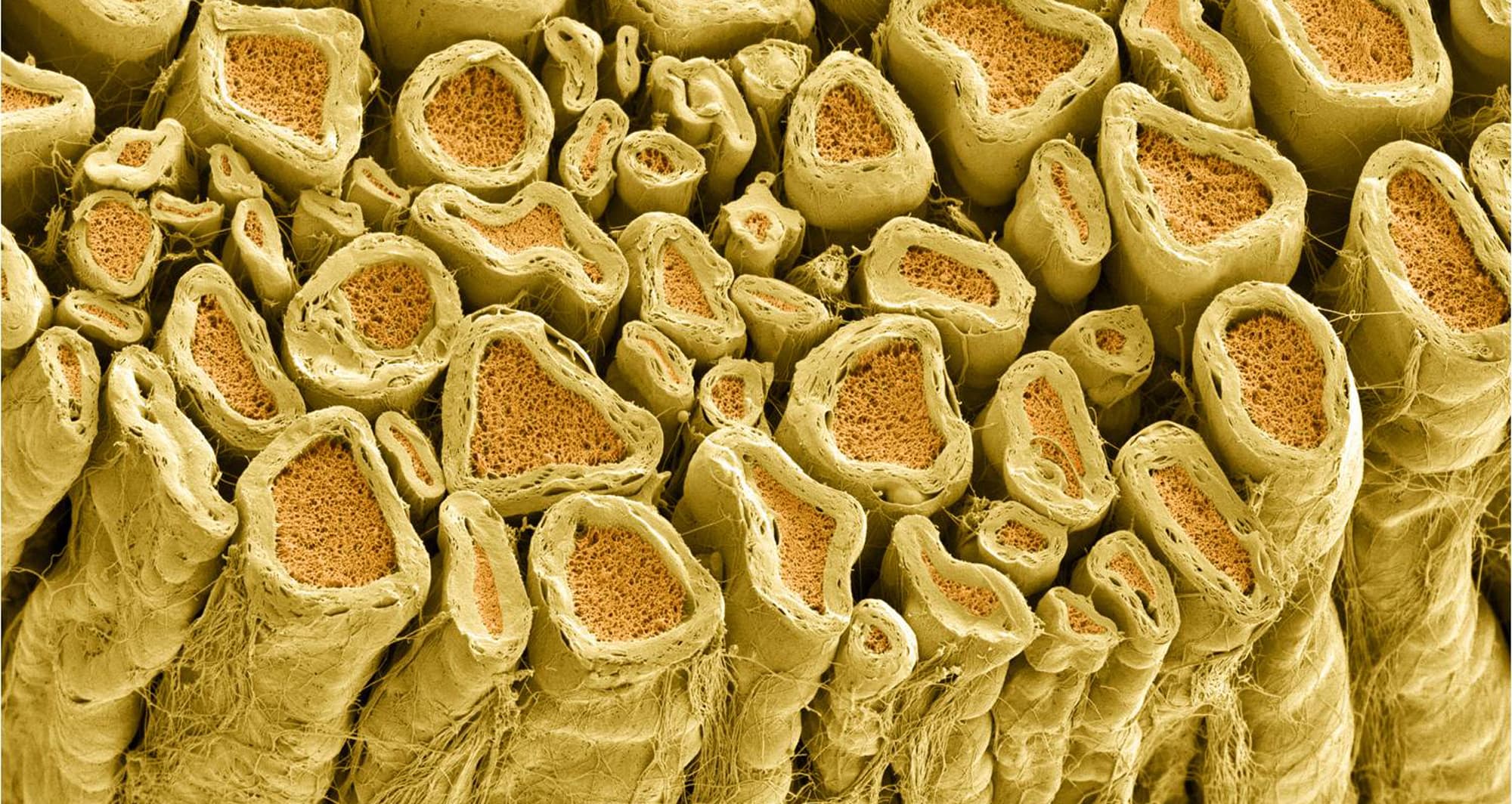 Myelinated axons in a rat spinal root