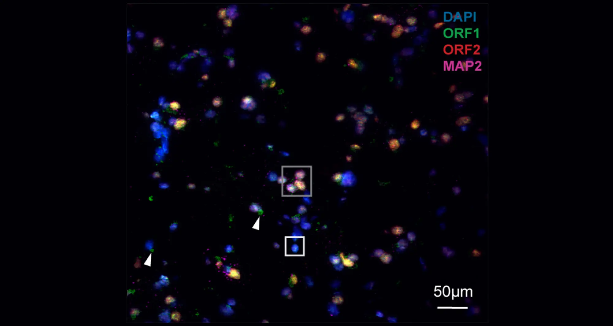 Results from using RNAscope technology to detect novel truncated RNAs in the aging human brain