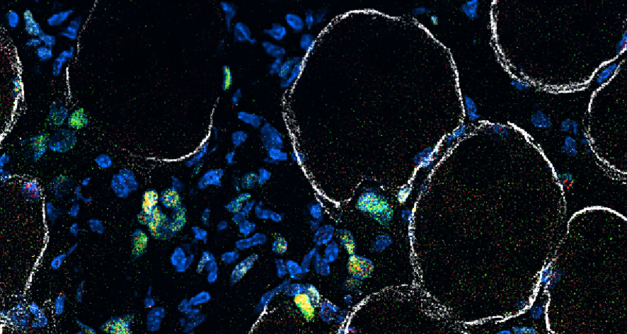 After an injury, muscle stem cells activate and must expand in number to repair and make new muscle (marked by dystrophin in white). Stem cells at different stages of making muscle are stained in red, green and yellow
