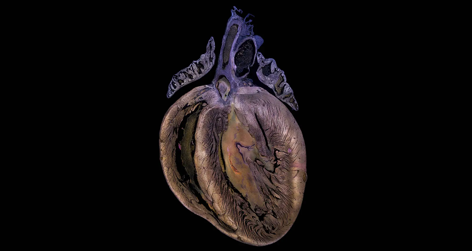 mammal heart - Image credit: Hillary Guzik, Rochester Institute of Technology