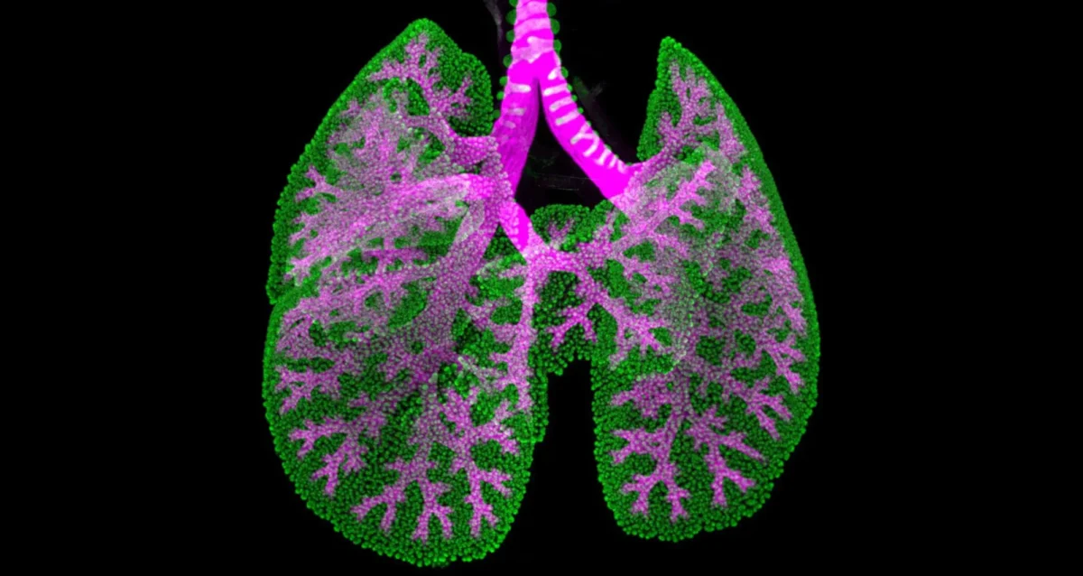 optical projection tomograph depicts the lung of a 16 ½ day old embryonic mouse, with airways highlighted in pink and epithelial progenitors in green