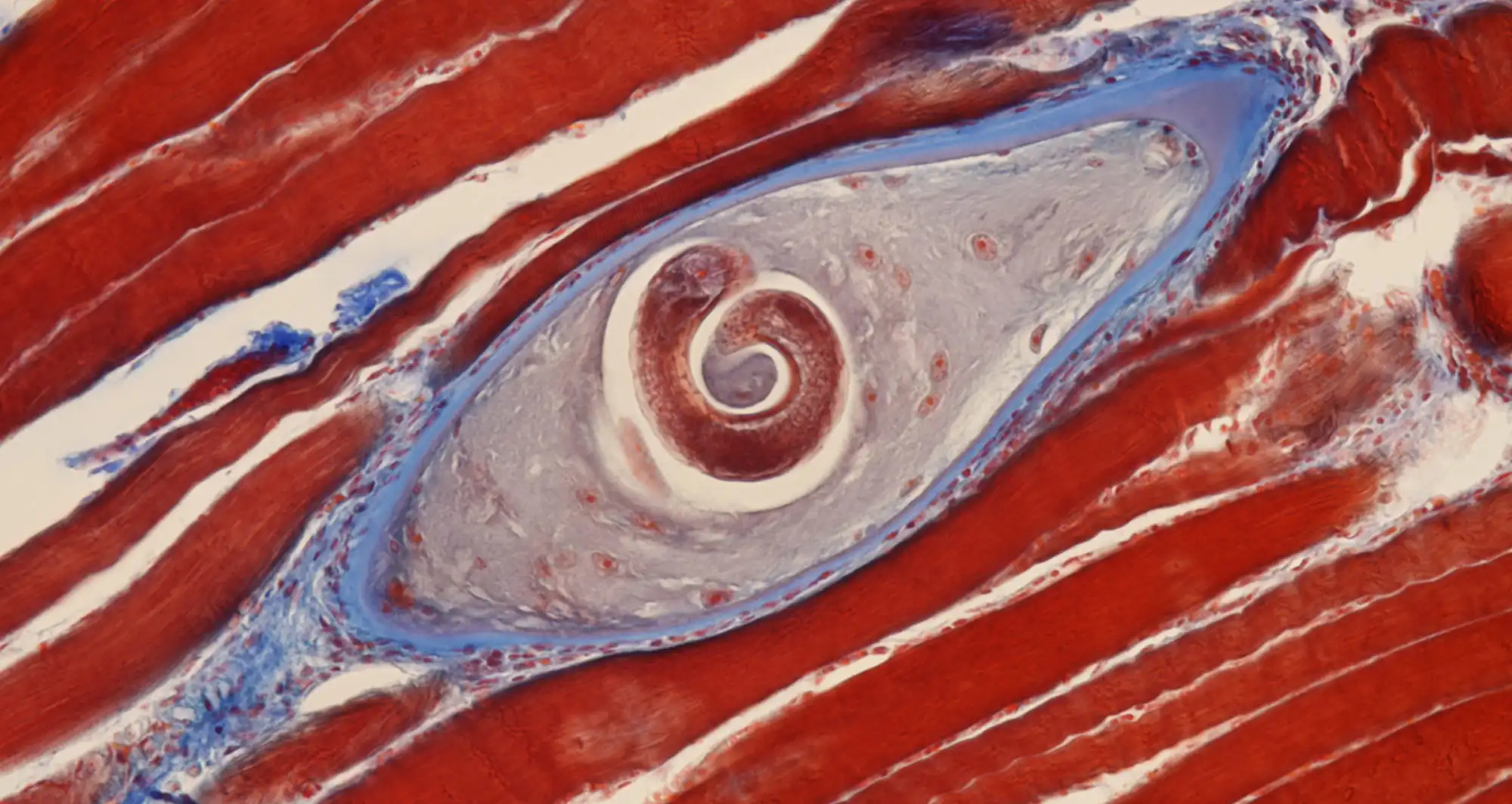 trichinella cyst is depicted in pork muscle - Image credit: Nathan P. Myhrvold, Modernist Cuisine