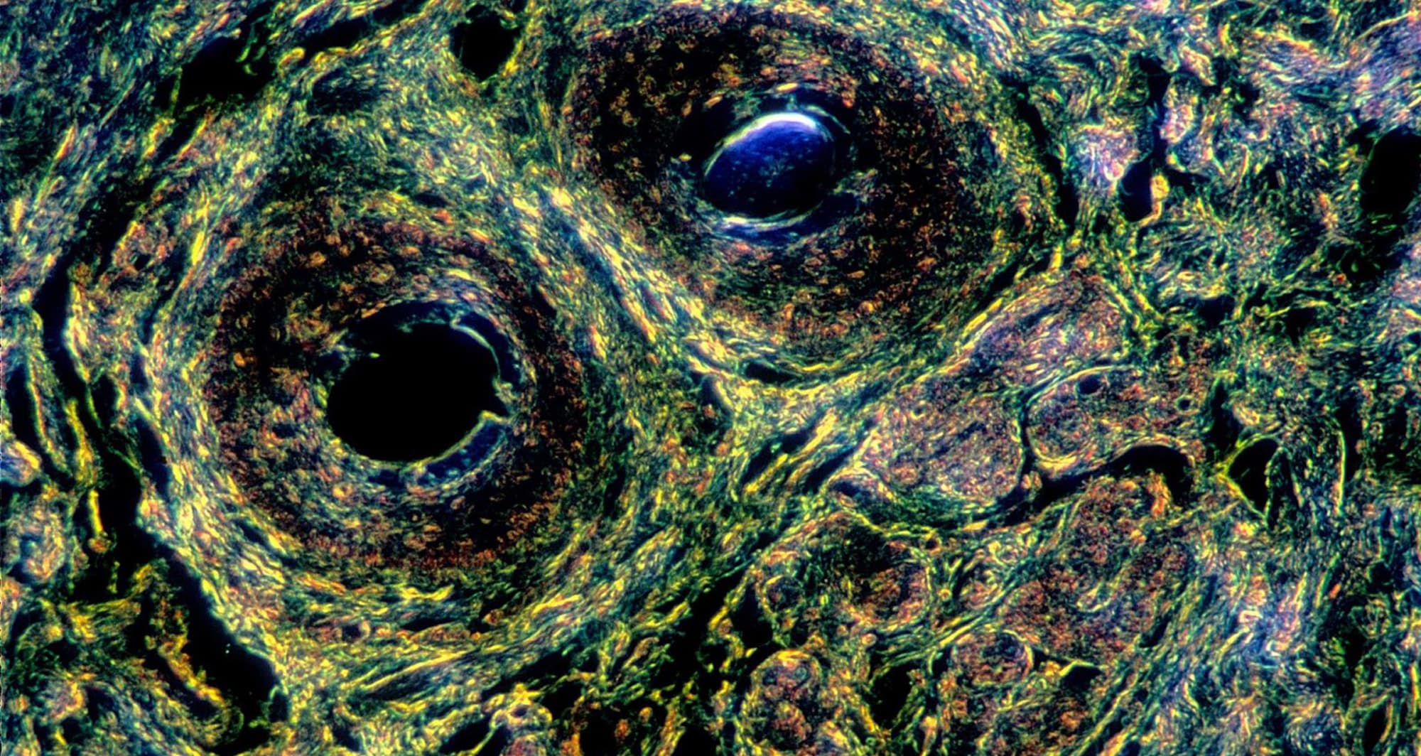 Darkfield micrograph of human scalp section. Image courtesy of Anita L. Tellier, Rochester Institute of Technology.